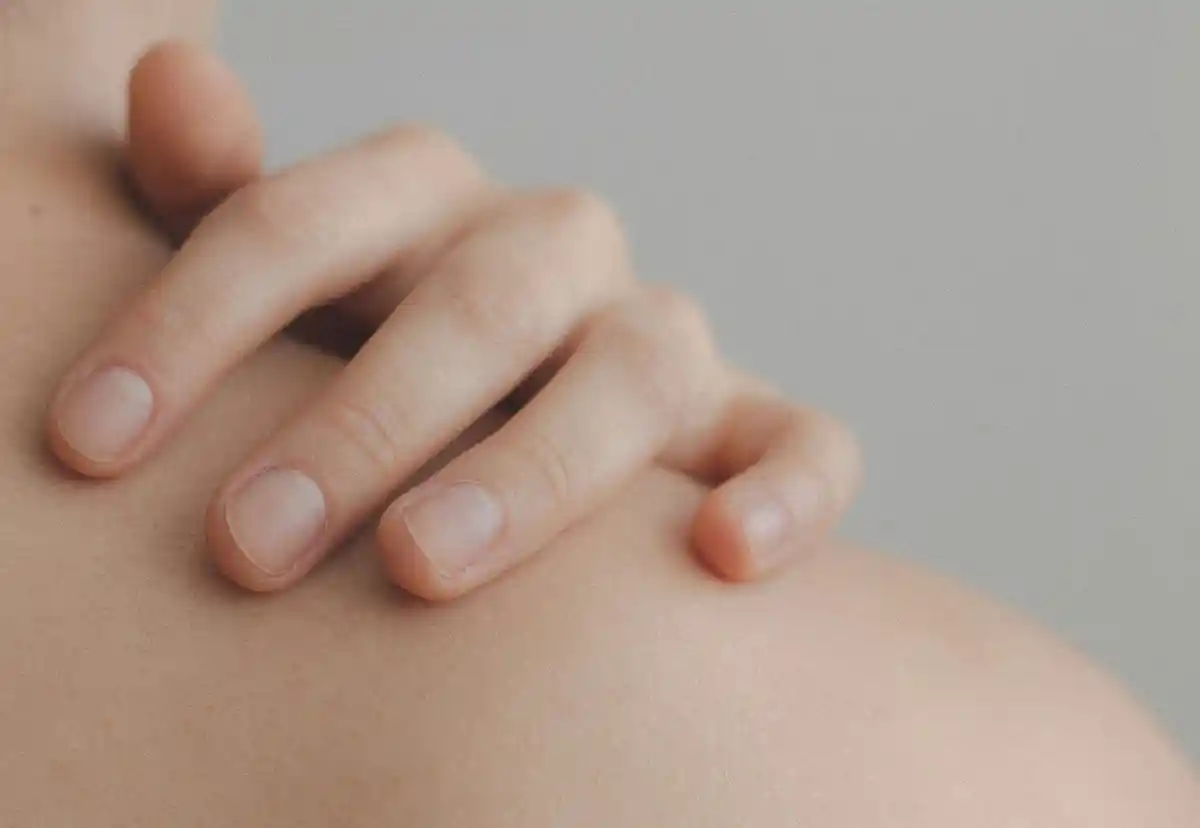 습진으로 인해 가려움을 호소하는 여성의 피부